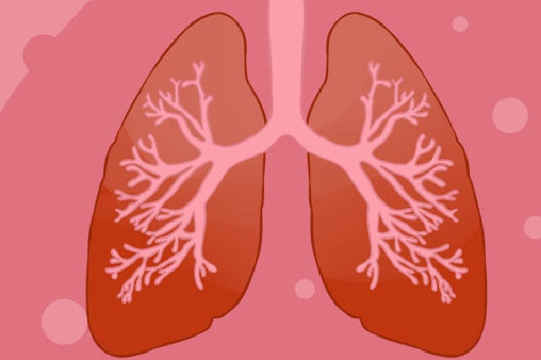 肺囊性纤维化怎么办