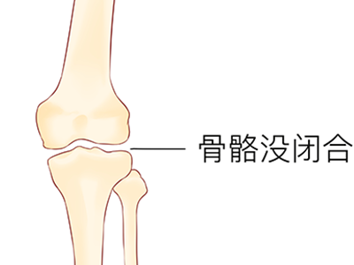 18岁以后还能长高吗