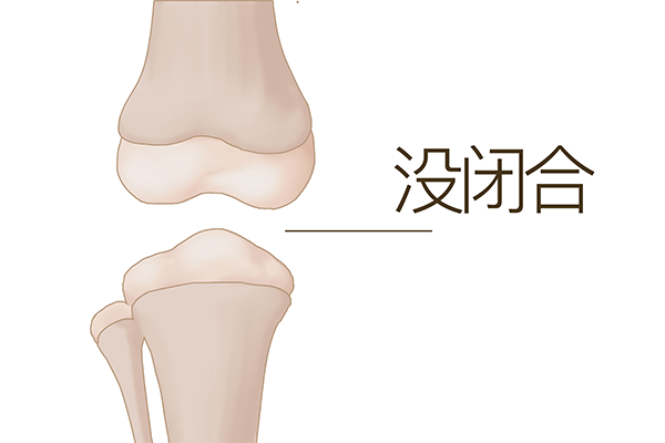 17岁可以打生长激素长高吗